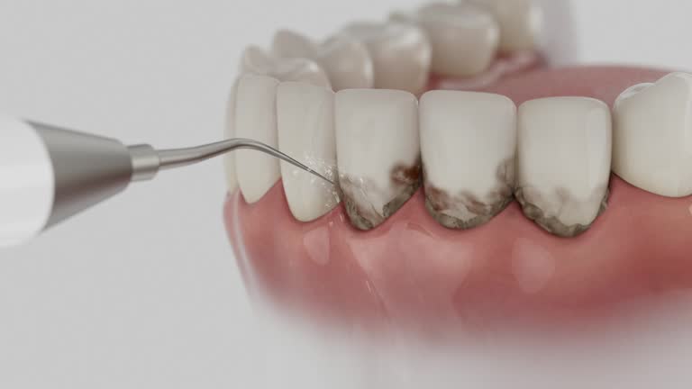 Reliable Tooth Extraction contractor in Cooke County County, TX by Dentist Open Now